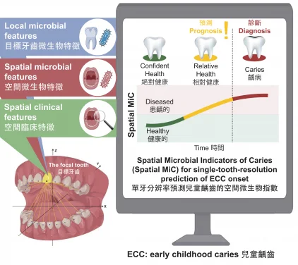 HKU Dentistry develops world’s first AI system for single-tooth prediction of early childhood caries detection with over 90% accuracy