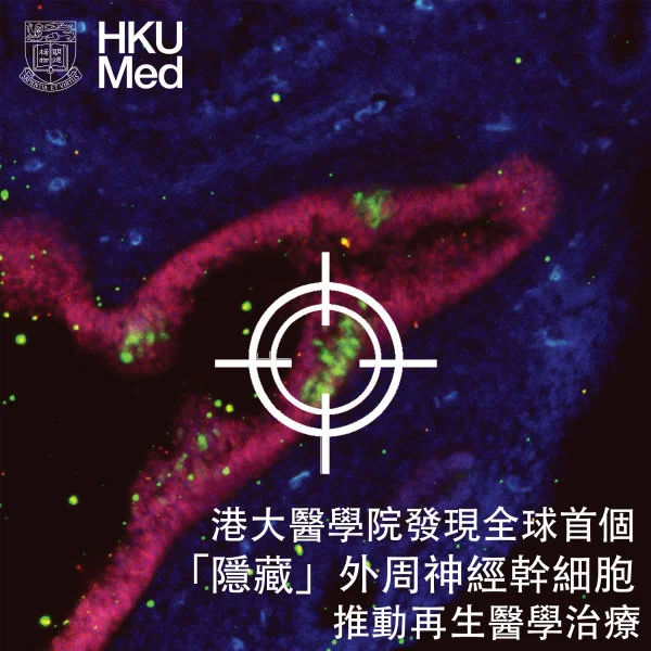 Peripheral neural stem cells (pNSCs)   