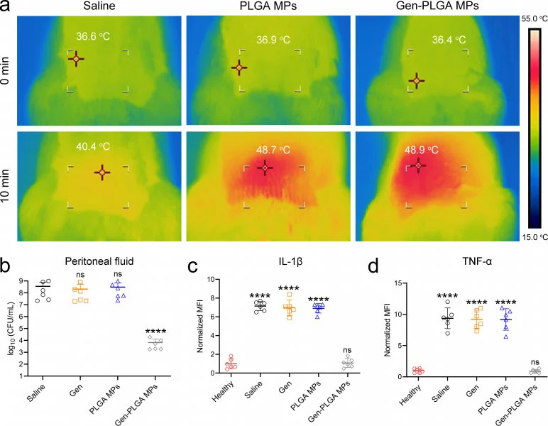 Treatment efficacy：Peritoneal infection: a) Thermal images indicating the skin temperature over peritoneal location after injection with saline, PLGA MPs, and Gen-PLGA MPs after MWH irradiation for 10 min. b) MDR E. coli bacterial burden in the peritoneal fluid after different interventions. Obviously, the number of bacteria in Gen-PLGA MPs group has been significantly reduced. c–d) Quantification of the mean fluorescence intensity (MFI) of the expressions of IL-1β (c) and TNF-α (d) by immunofluorescence staining normalised to the mean of non-infected subject (Healthy). High expression of those cytokines can be observed in saline, gentamicin and PLGA MPs groups, whereas the group of gentamicin-loaded PLGA MPs bears no difference from the healthy controls.  