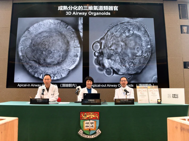HKUMed researchers develop the world’s first organoid-based platform to evaluate the therapeutic potential of neutralising antibodies in the human body, providing more reliable scientific evidence for clinical treatment. The research team includes (from right): Professor Kelvin To Kai-wang, Professor Jane Zhou Jie and Dr Li Cun.