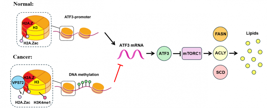 Mechanism of how genetic player VPS72 impacts liver cancer. Too much VPS72 in cells activates the cancer-promoting pathway, which increases fat production and helps liver cancer grow. This study shows a new connection between fat buildup and liver cancer, suggesting new treatment possibilities. Image adapted from the respective paper at Advanced Science.