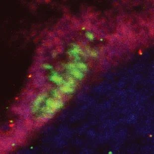 Peripheral neural stem cells (pNSCs)   