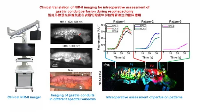 HKU Achieves First Clinical Use of Next-Generation Infrared Fluorescence Imaging to Help Surgeons See Blood Perfusion During Esophageal Surgery