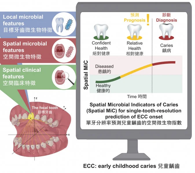 HKU Dentistry developed Spatial-MiC, the world’s first AI system for early childhood caries detection at the single-tooth resolution.