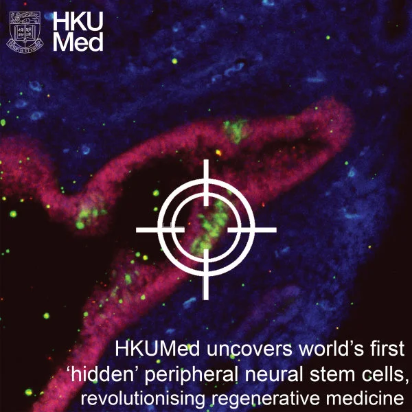 Peripheral neural stem cells (pNSCs)   