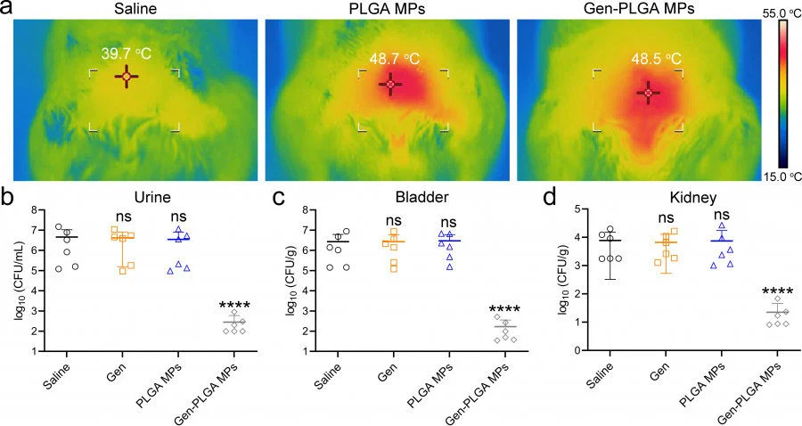 Treatment efficacy：Urinary tract infection: a) Thermal images indicating the skin temperature over the bladder after injection with saline, PLGA microparticles (MPs), and gentamicin-loaded PLGA MPs (Gen-PLGA MPs), and microwave hyperthermal (MWH) irradiation for 10 minutes. b–d) MDR E. coli bacterial burden in b) urine, c) the bladders, and d) the kidneys after different interventions. It’s obvious that the group of gentamicin-loaded PLGA MPs after MWH can significantly reduce the bacterial load as compared with other groups.  